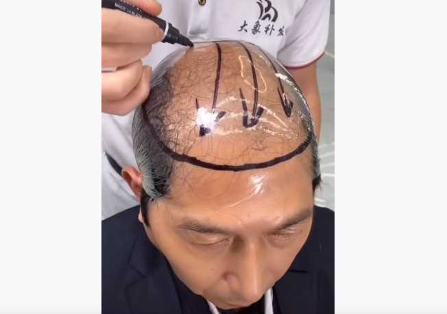 中国の薄毛用ウイッグ  芸術的な理容師のテクニック